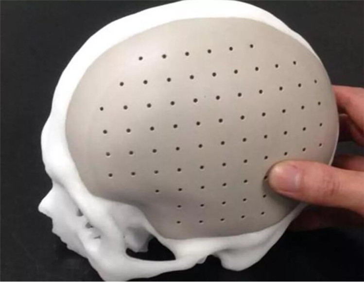 3811639615210525 3811639615210525