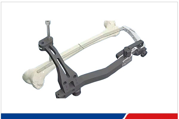 远端锁定用PEEK瞄准架